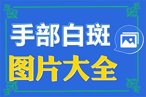 东莞什么医院有机会看好白癜风