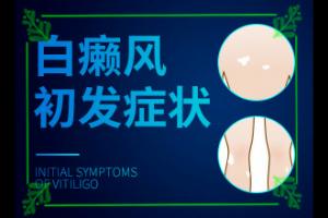 疼癜风论坛东莞去哪家-东莞治疗白癜风哪块好