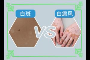东莞附近虎门看白癜风好的医院