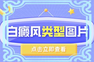 兰州安宁区有几家专科治疗白癜风的医院