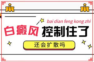 东莞那间医院治疗白癜风较好