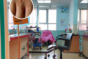 小孩12岁白颠疯能治好吗