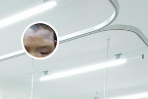 儿童白点癫风可以治吗