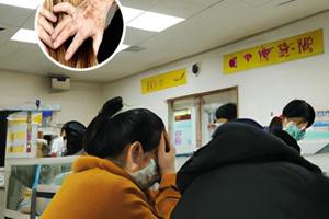 白癜风早期能治愈吗用什么药