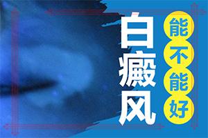 东莞白癜风在哪家医院治好呀