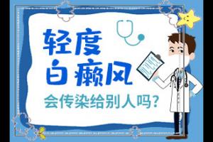 东莞大面积白癜风医院-东莞哪家医院有308激光治疗