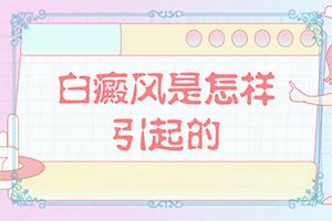 东莞哪个医院白癜风科比较好