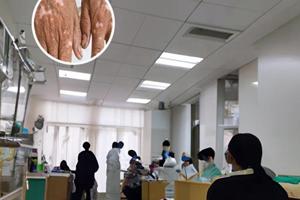 白癜风的发病有哪些具体的原因