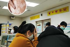 手上白点癫风怎么治疗最快最有结果