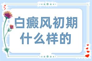 兰州城关区哪个治白癜风的医院好复发吗