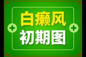 伍德灯检查去东莞放心-东莞治疗白癜风哪里比较