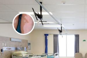 甲泼尼龙注射剂最多用几天
