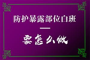 东莞哪个正规医院治疗白癜风