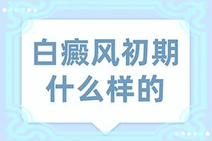 兰州七里河区哪里医院治疗白癜风较好