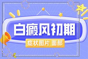 东莞哪个医院治白癜风治的好