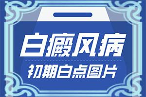东莞治疗儿童白癜风好的医院是哪个