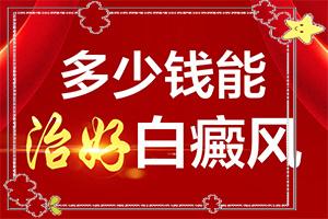 东莞东莞看白癜风的医院是在哪里